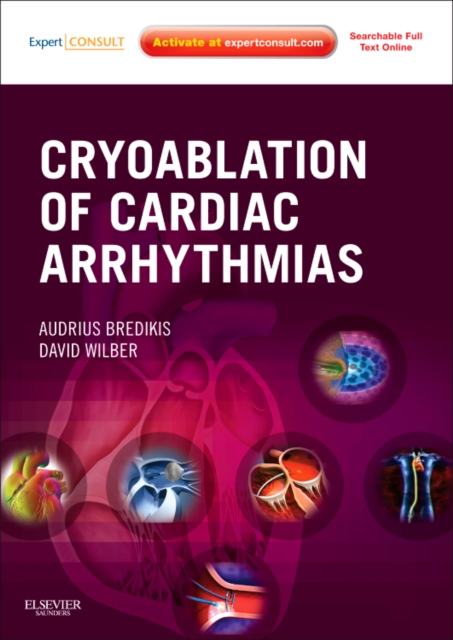 Cryoablation of Cardiac Arrhythmias, Mixed media product Book