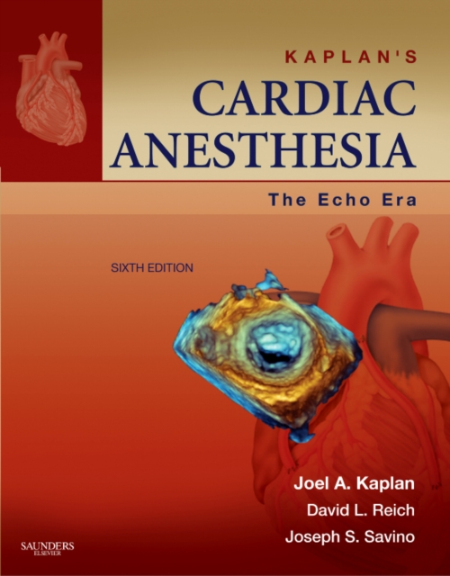 Kaplan's Cardiac Anesthesia: The Echo Era : Expert Consult Premium Edition - Enhanced Online Features and Print, Mixed media product Book