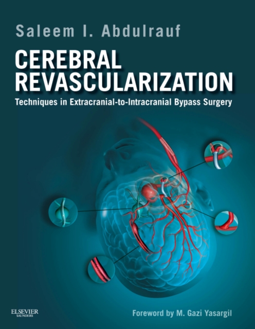 Cerebral Revascularization : Techniques in Extracranial-to-Intracranial Bypass Surgery, Mixed media product Book