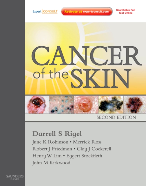 Cancer of the Skin : Expert Consult - Online and Print, Hardback Book