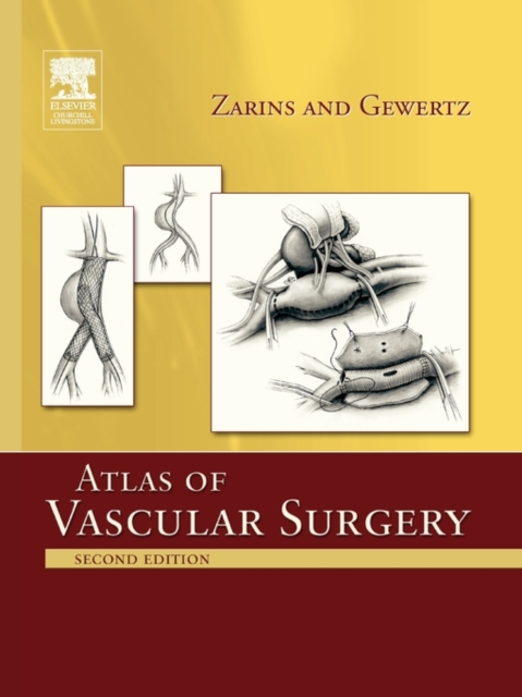 Atlas Of Vascular Surgery - Paperback Edition, Paperback / softback Book