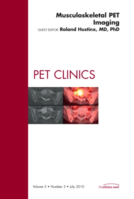 Musculoskeletal PET Imaging, An Issue of PET Clinics : Volume 5-3, Hardback Book