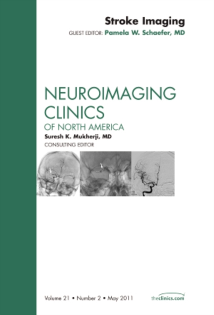 Stroke Imaging, An Issue of Neuroimaging Clinics : Volume 21-2, Hardback Book