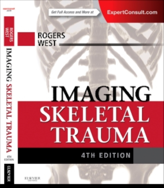 Imaging Skeletal Trauma, Hardback Book