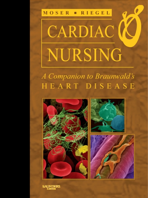 Cardiac Nursing E-Book : Cardiac Nursing E-Book, EPUB eBook