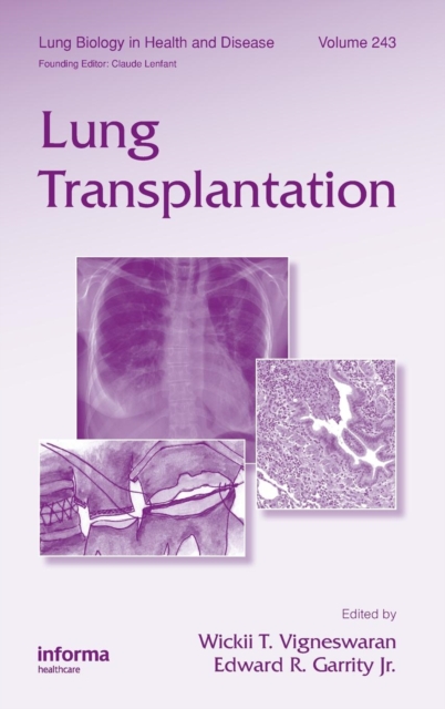 Lung Transplantation, Hardback Book