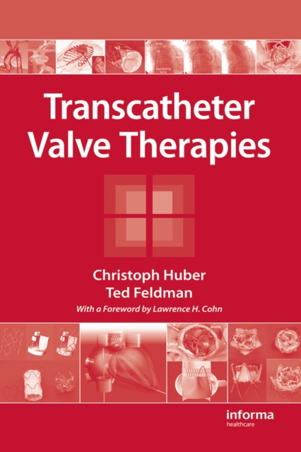 Transcatheter Valve Therapies, PDF eBook