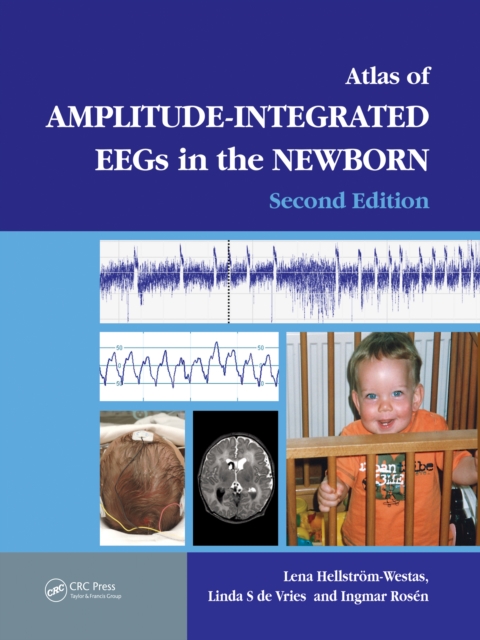 An Atlas of Amplitude-Integrated EEGs in the Newborn, PDF eBook