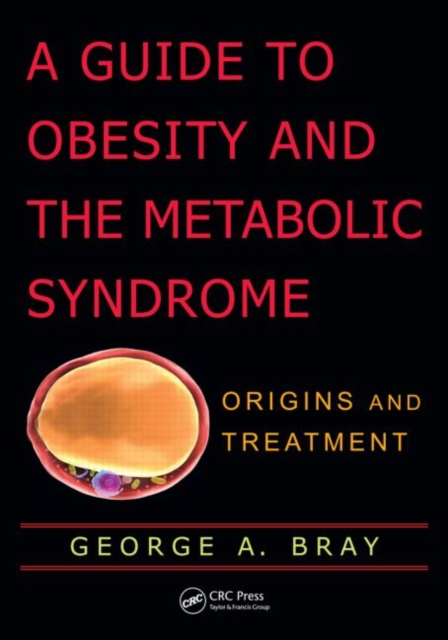 A Guide to Obesity and the Metabolic Syndrome : Origins and Treatment, Hardback Book