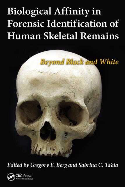 Biological Affinity in Forensic Identification of Human Skeletal Remains : Beyond Black and White, PDF eBook