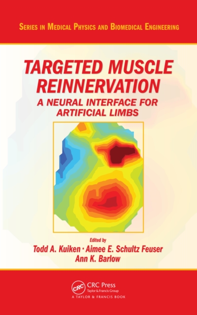 Targeted Muscle Reinnervation : A Neural Interface for Artificial Limbs, PDF eBook