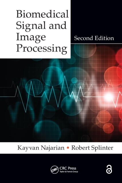 Biomedical Signal and Image Processing, PDF eBook