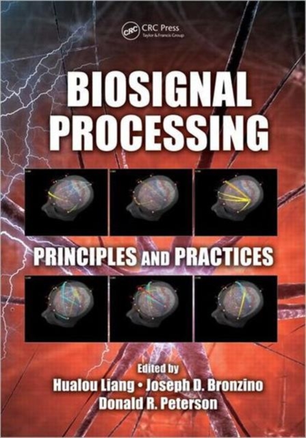 Biosignal Processing : Principles and Practices, Hardback Book