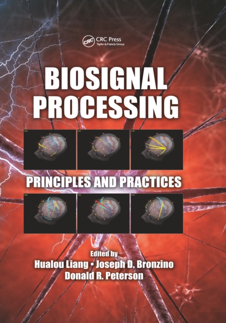 Biosignal Processing : Principles and Practices, PDF eBook