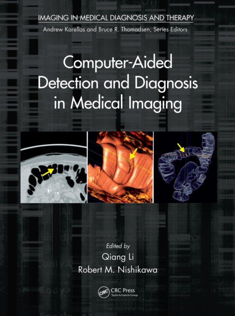Computer-Aided Detection and Diagnosis in Medical Imaging, PDF eBook