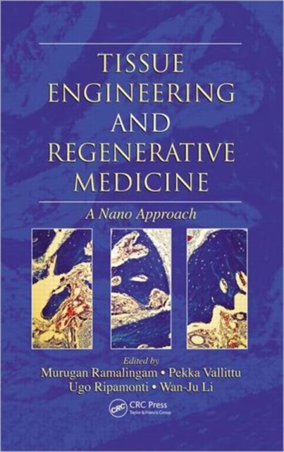 Tissue Engineering and Regenerative Medicine : A Nano Approach, Hardback Book