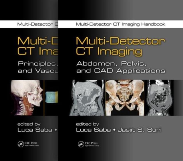 Multi-Detector CT Imaging Handbook, Two Volume Set, Multiple-component retail product Book