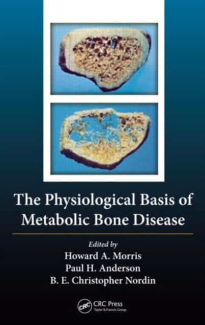 The Physiological Basis of Metabolic Bone Disease, Hardback Book
