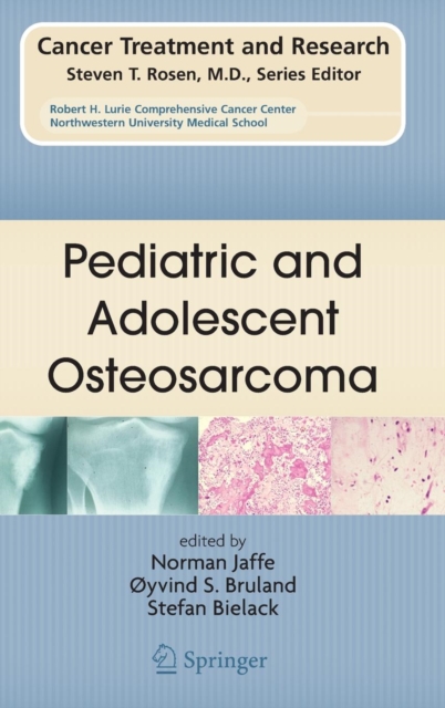 Pediatric and Adolescent Osteosarcoma, Hardback Book