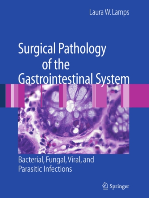 Surgical Pathology of the Gastrointestinal System: Bacterial, Fungal, Viral, and Parasitic Infections, PDF eBook