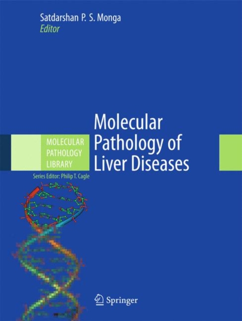 Molecular Pathology of Liver Diseases, Hardback Book