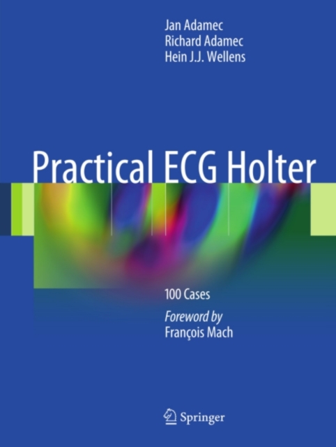 Practical ECG Holter : 100 Cases, PDF eBook