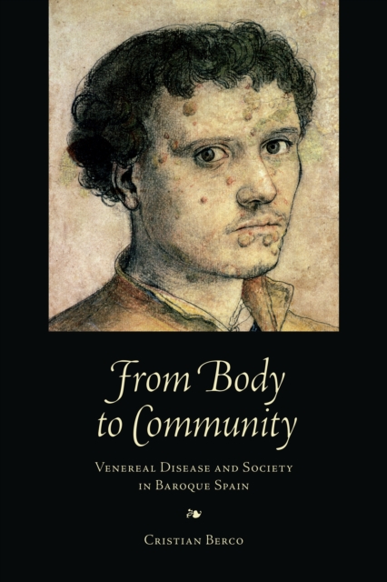 From Body to Community : Venereal Disease and Society in Baroque Spain, PDF eBook