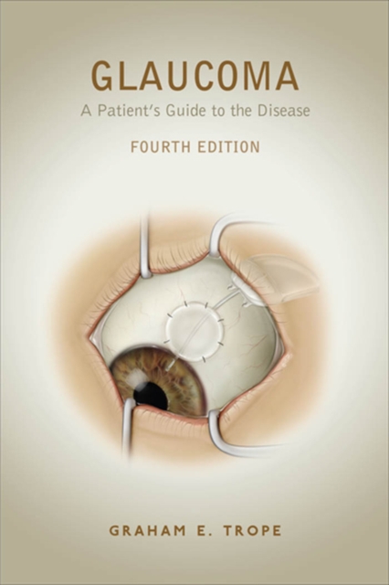 Glaucoma : A Patient's Guide to the Disease, Fourth Edition, PDF eBook