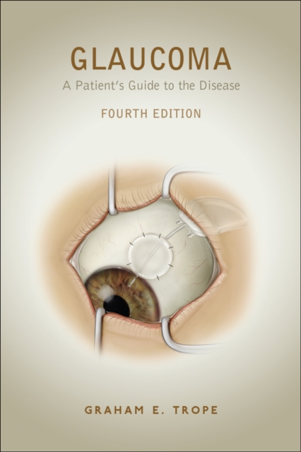 Glaucoma : A Patient's Guide to the Disease, Fourth Edition, EPUB eBook