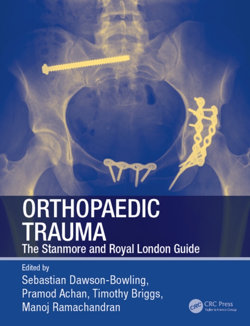 Orthopaedic Trauma : The Stanmore and Royal London Guide, PDF eBook