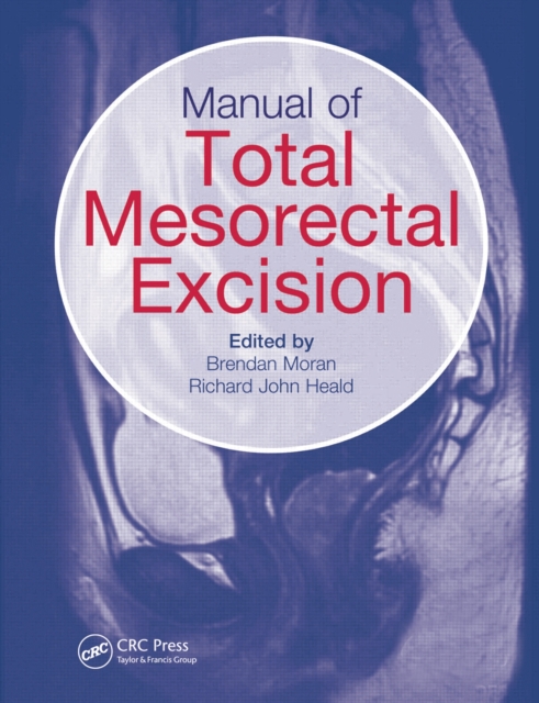 Manual of Total Mesorectal Excision, PDF eBook