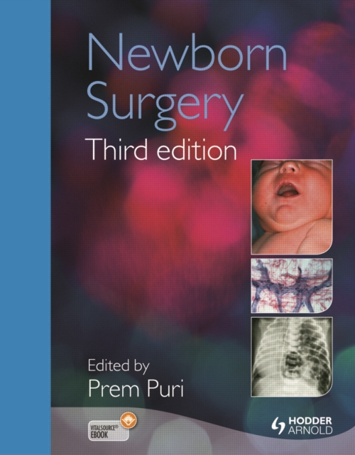 Newborn Surgery 3E, PDF eBook