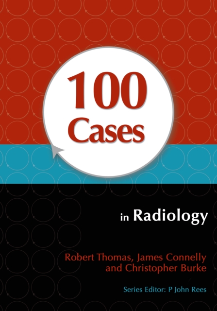 100 Cases in Radiology, PDF eBook