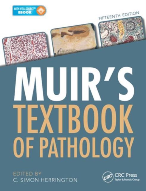 Muir's Textbook of Pathology, Hardback Book