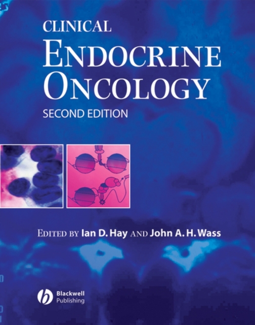 Clinical Endocrine Oncology, PDF eBook