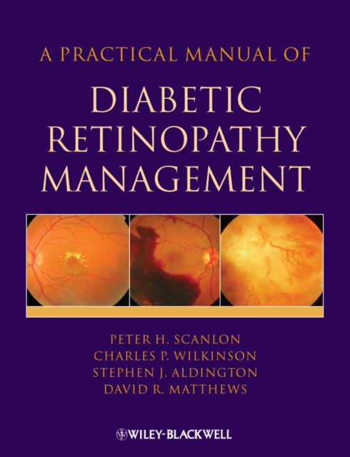 A Practical Manual of Diabetic Retinopathy Management, PDF eBook