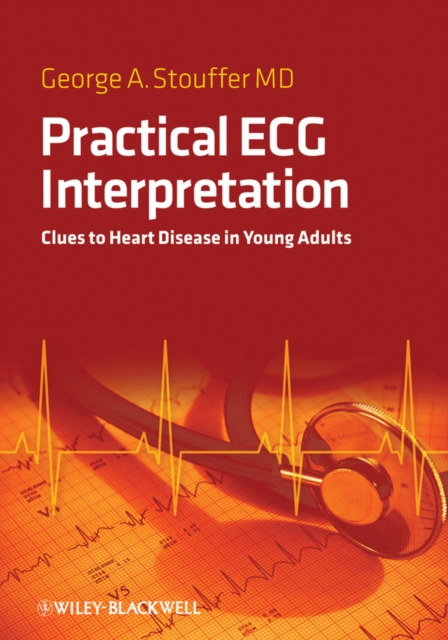 Practical ECG Interpretation : Clues to Heart Disease in Young Adults, PDF eBook