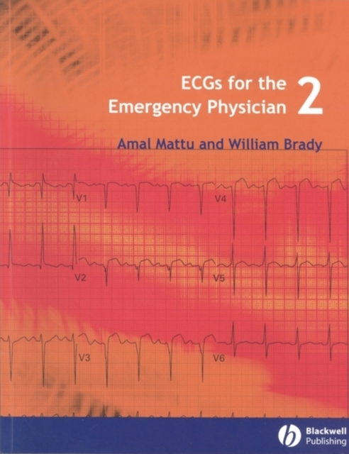 ECGs for the Emergency Physician 2, PDF eBook