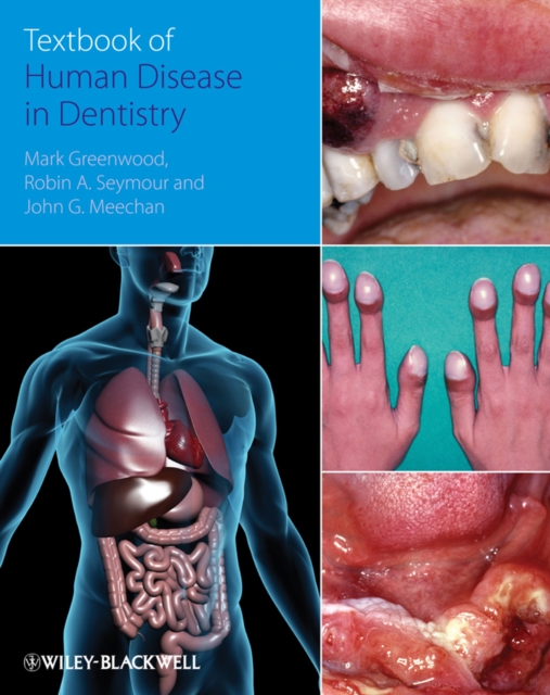 Textbook of Human Disease in Dentistry, PDF eBook