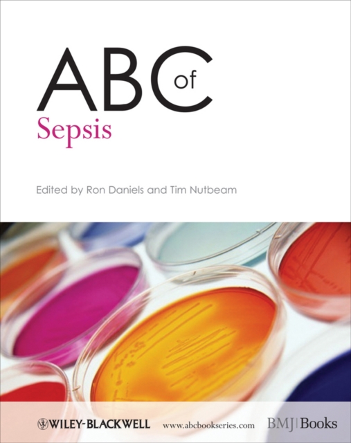 ABC of Sepsis, PDF eBook