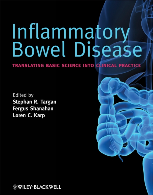 Inflammatory Bowel Disease : Translating Basic Science into Clinical Practice, PDF eBook