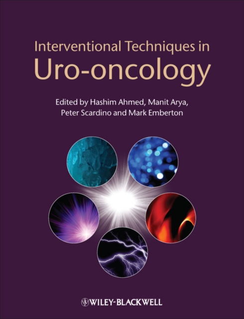 Interventional Techniques in Uro-oncology, PDF eBook