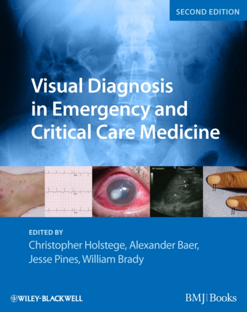 Visual Diagnosis in Emergency and Critical Care Medicine, Paperback / softback Book
