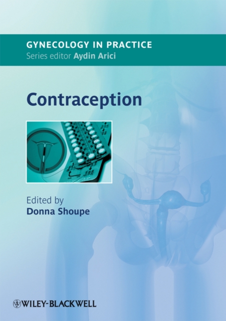 Contraception, Paperback / softback Book