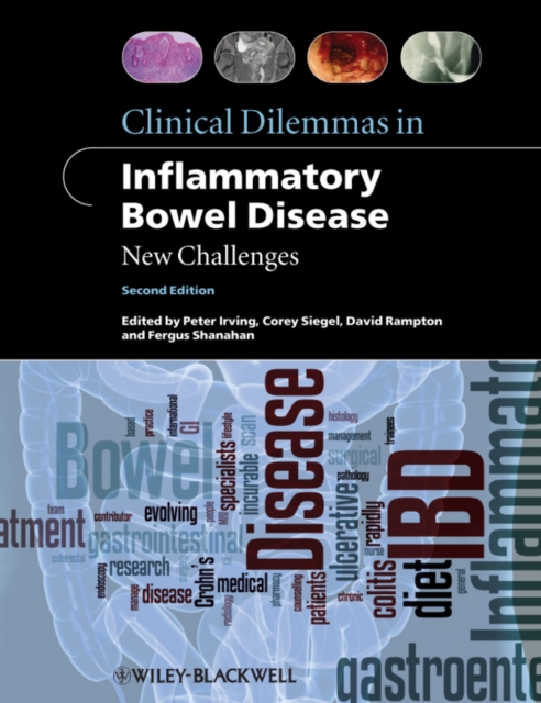 Clinical Dilemmas in Inflammatory Bowel Disease : New Challenges, Paperback / softback Book