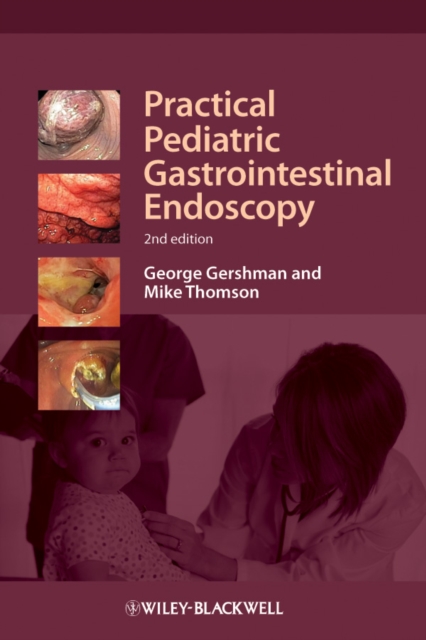 Practical Pediatric Gastrointestinal Endoscopy, Hardback Book