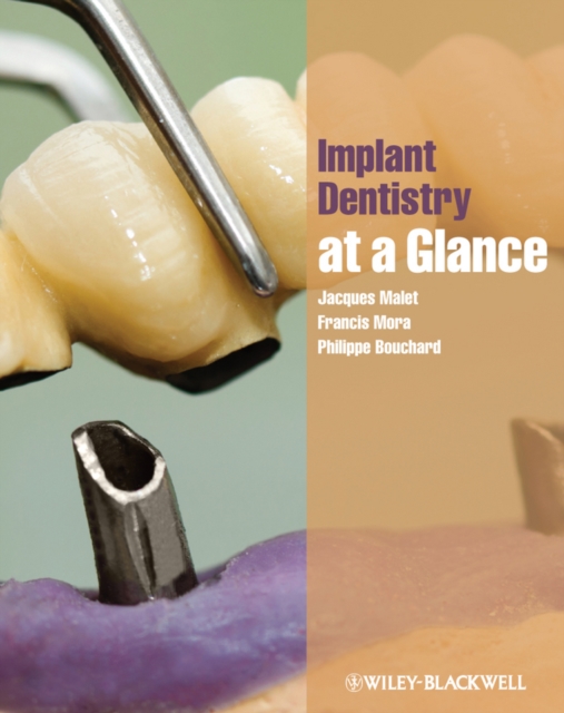 Implant Dentistry at a Glance, Paperback Book