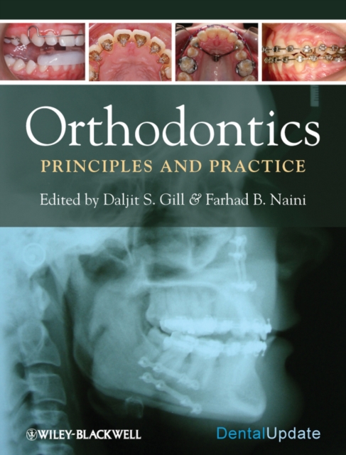 Orthodontics : Principles and Practice, PDF eBook