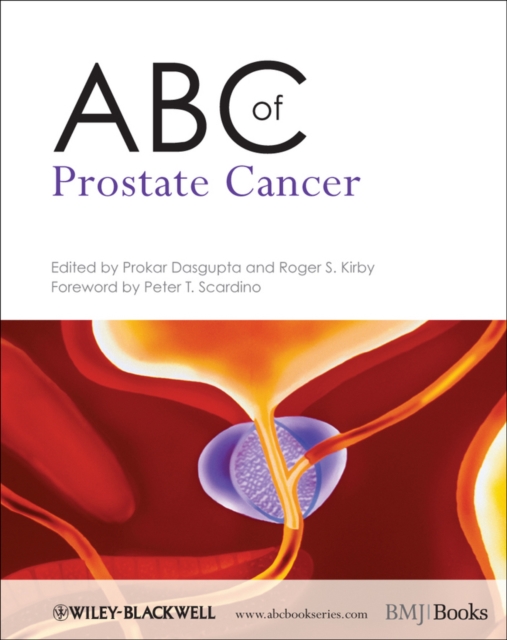 ABC of Prostate Cancer, PDF eBook