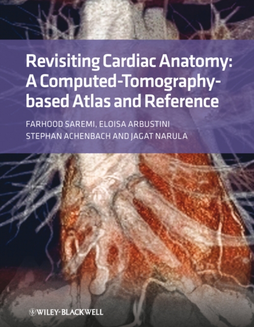 Revisiting Cardiac Anatomy : A Computed-Tomography-Based Atlas and Reference, EPUB eBook